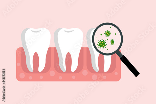 Vector illustration of teeth with magnifier glass showing bacteria. Medical concept.  