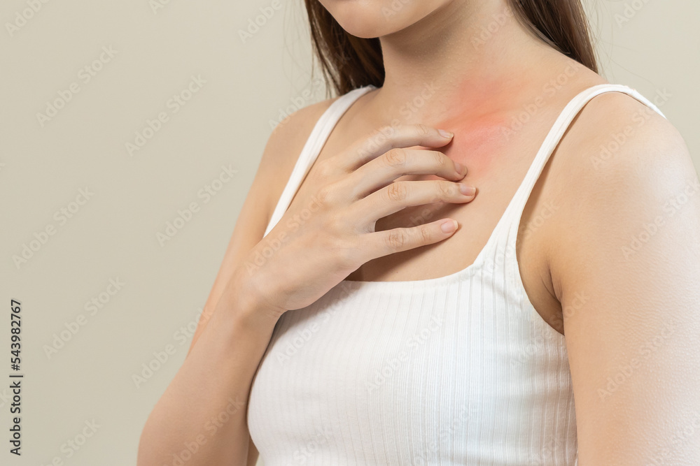 Dermatology, asian young woman, girl allergy, allergic reaction from atopic, insect bites on her body, hand in scratching itchy, itch red spot or rash of skin. Healthcare, treatment of beauty. Dermatology, asian young woman, girl allergy, allergic reaction from atopic, insect bites on her body, hand in scratching itchy, itch red spot or rash of skin. Healthcare, treatment of beauty.