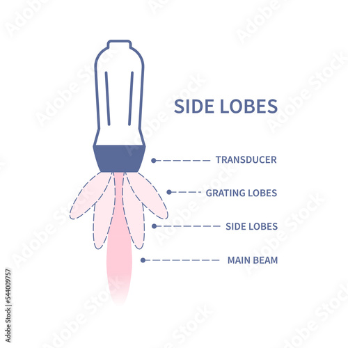 Ultrasound artifacts caused by side and grading lobes of the main beam of the transducer. Medical sonography concept. Radiology equipment vector illustration.