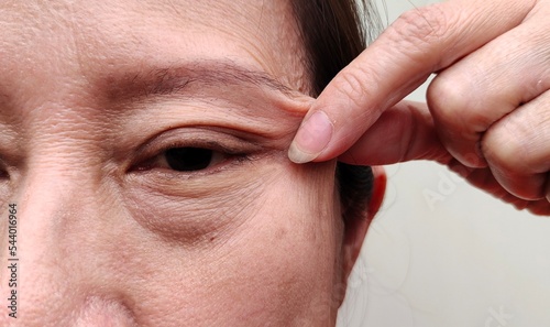 Fotografia Portrait the fingers holding the flabbiness adipose sagging skin beside the eye, ptosis and wrinkles on the eyelid, problem blemish and freckles on the face of the woman, concept health care