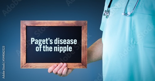 Paget's disease of the nipple (Paget’s disease of the breast). Doctor shows sign/board with wooden frame. Background blue photo