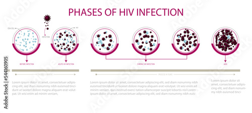 Phases in HIV infection. CD24 cells.