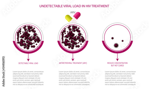 Undetectable Viral Load in HIV Treatment