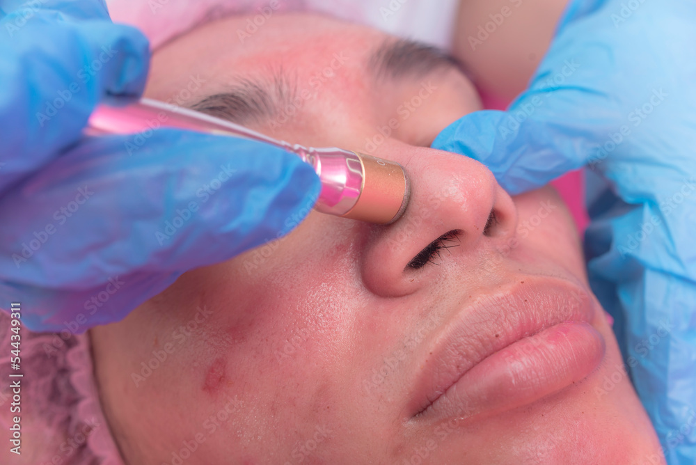 An Esthetician performs a Diamond peel facial, a type of microdermabrasion procedure. Exfoliating the skin of the face. At a aesthetic or dermatology clinic. An Esthetician performs a Diamond peel facial, a type of microdermabrasion procedure. Exfoliating the skin of the face. At a aesthetic or dermatology clinic.