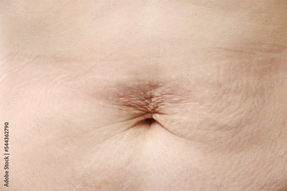 close up of careful scar after surgery on the body. close up of careful scar after surgery on the body.
