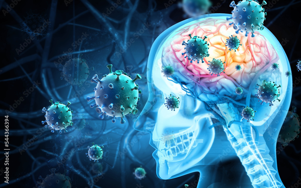 Brain viral infection, Viral meningitis and encephalitis. 3d