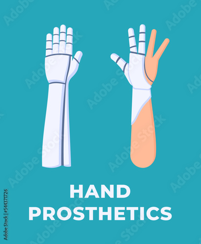 Vector illustration of an isolated hand prosthesis on a blue background. Prosthetic arm for a person. Model. Manufacturing. Help for people with health problems. Hand.