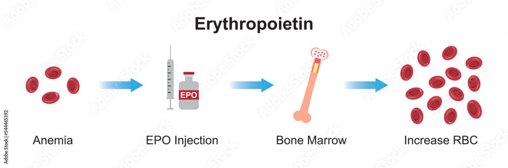 Scientific Designing of Erythropoietin (EPO) Effect on Bone After ...
