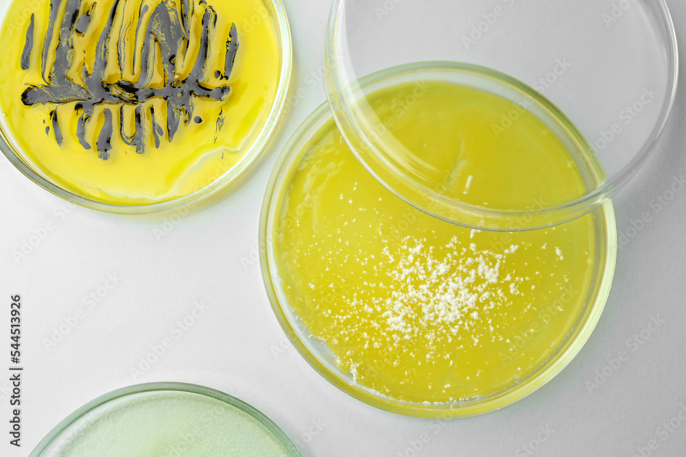 Petri dishes with different bacteria colonies on white background, flat lay Petri dishes with different bacteria colonies on white background, flat lay