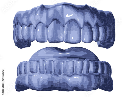 Molde de dentadura. Férula y estetica dental.