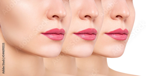 Female lips after augmentation and correcting the shape of the lips. photo