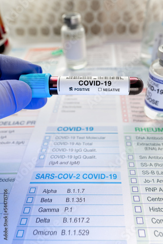 Doctor holding tube of blood sample in the laboratory identified with Positive COVID-19 or Coronavirus. Technican testing blood sample with presence positive to coronavirus photo