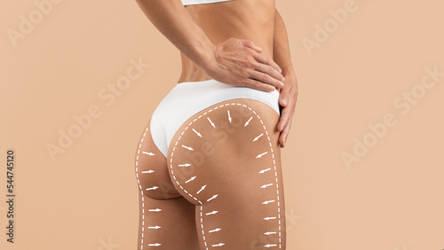 Anti-Cellulite Treatment. Perfect Female Buttocks With Drawn Lifting Up Lines And Arrows photo