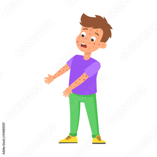 boy with large rash on his arms with signs of chickenpox disease. Cute children as medical patient vector illustration. Disease symptoms cartoon kid on white background. Health