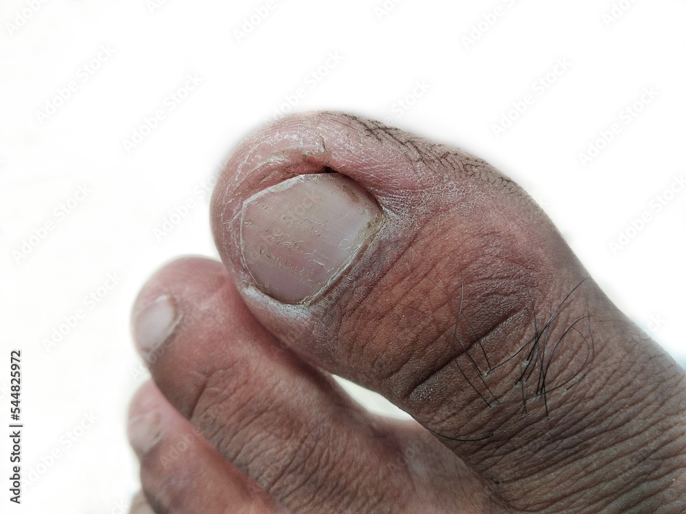 Close up toe foot fingers isolated on white background Close up toe foot fingers isolated on white background