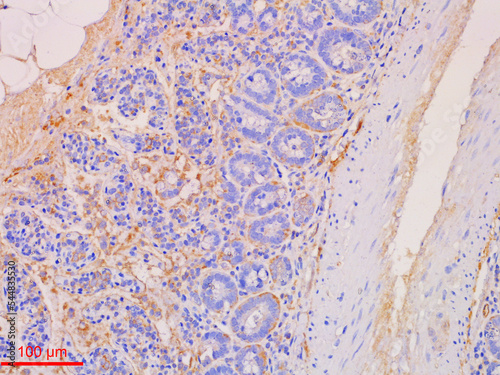 Immunohistochemistry Staining in Histopathology