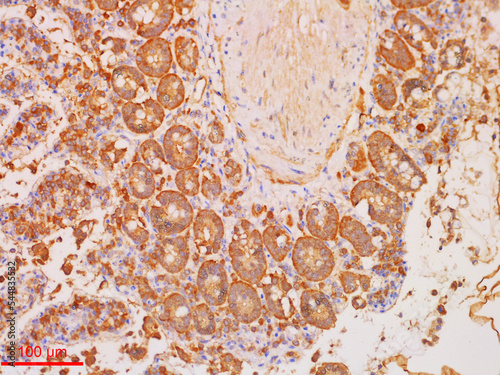 Immunohistochemistry Staining in Histopathology