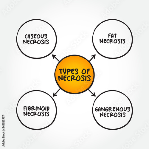 Types of Necrosis (death of body tissue) mind map text concept for presentations and reports