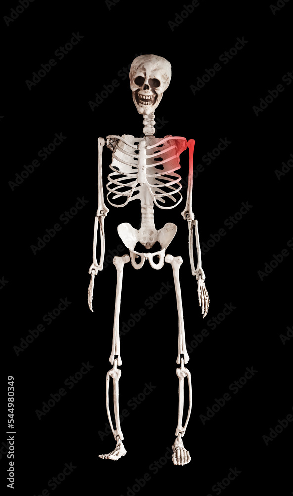 Shoulder pain, clavicle trauma, collarbone and acromion fracture, injury concept Stock Photo