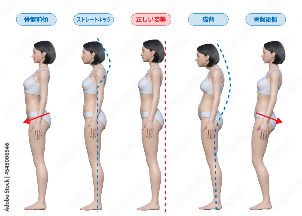 正しい姿勢と悪い姿勢 猫背 ストレートネック 骨盤前傾 後傾の3Dイラスト 全身横向き 横顔