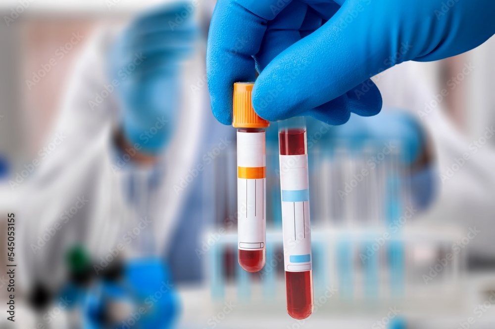 Medical sample for blood test in laboratory Medical sample for blood test in laboratory