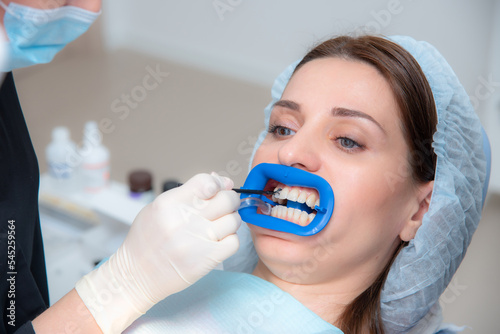 Preparing the oral cavity for whitening with an ultraviolet lamp. Close-up