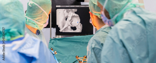 Team of doctor perform total hip, knee arthroplasty replacement surgery in osteoarthritis patient inside the operating room. mako technology
 photo