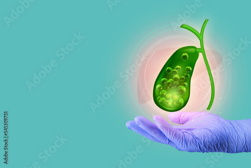 Gallbladder with stone. Care and treatment of gallstones, cholecystitis, surgical removal. modern digital medicine. Hand with glove and gallbladder. emerald green background photo