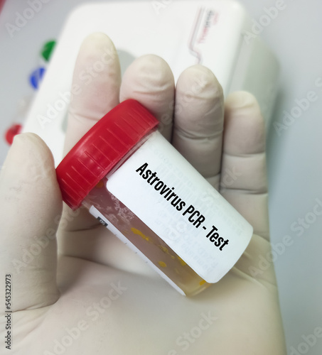 Laboratory scientist hold stool sample for Astrovirus PCR test, health and medical concept. Fecal virus test. photo