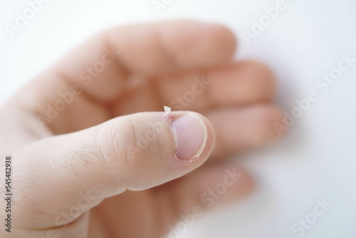 Men s manicure at home. Cut fingernails. Fingernails close-up. Untrimmed nails  burrs on the fingers  untidy manicure.