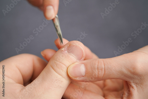Men s manicure at home. Cut fingernails. Fingernails close-up. Untrimmed nails  burrs on the fingers  untidy manicure.