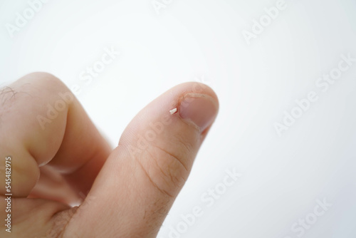 Men's manicure at home. Cut fingernails. Fingernails close-up. Untrimmed nails, burrs on the fingers, untidy manicure.