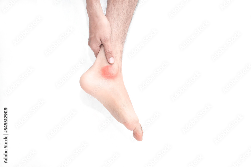 Tobillo rojizo adolorido por un esguince pie lastimado joven tocando su