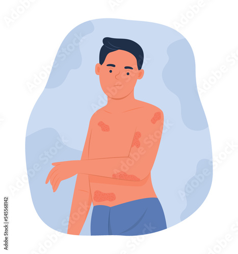 Man Looking Eczema on Body