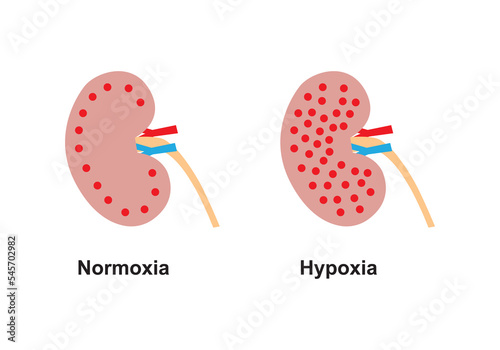 Scientific Designing of Comparison Between Normoxia and Hypoxia. Colorful Symbols. Vector Illustration. photo