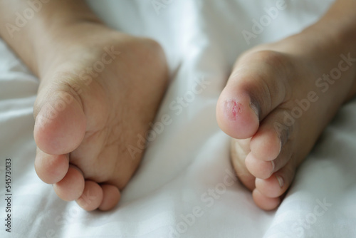 close up of dry child feet on bed ,