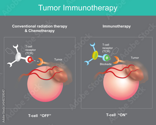 Tumor Immunotherapy. Cancer treatment that use the body's own immune system to prevent, control, and eliminate cancer cells. .