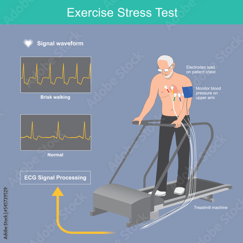 Exercise stress test. Older man the heart beat test on electric treadmill and results electric signal waveform display on monitor..