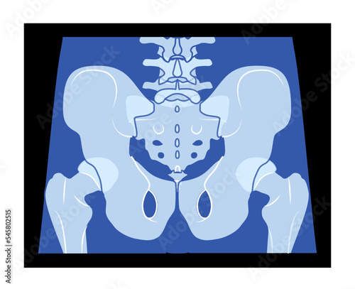 X-Ray pelvis Skeleton Hip Human body Bones adult people roentgen back view. 3D realistic flat blue color concept Vector illustration of medical anatomy isolated on black background