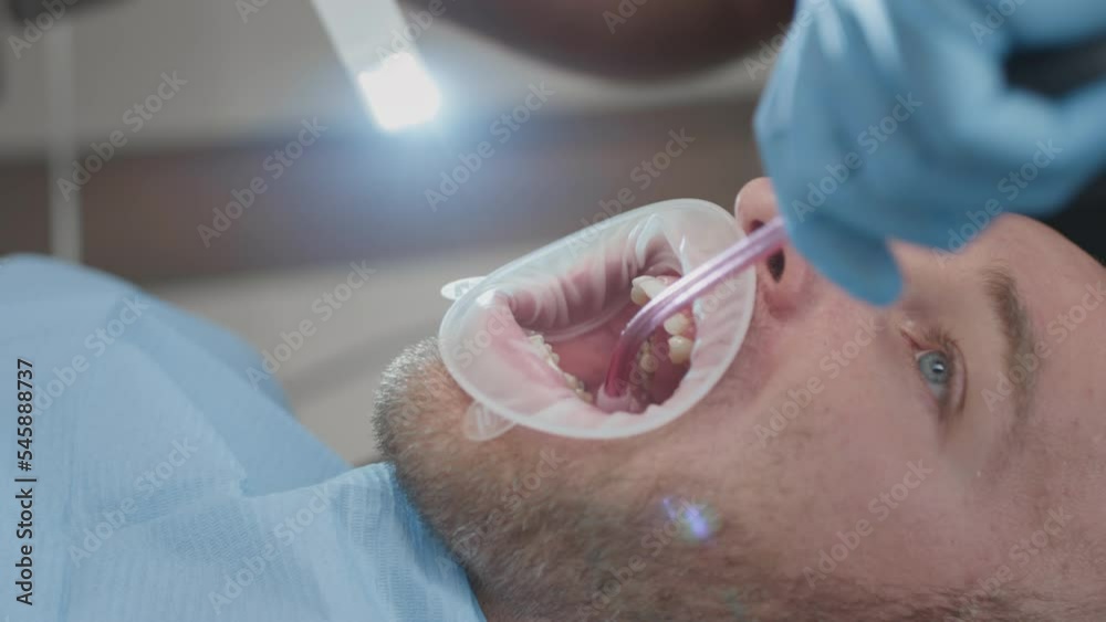 The use of vacuum cleaners and saliva pumps at the dentist's office