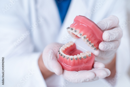 doctor orthodontist shows how the system of braces on teeth is arranged