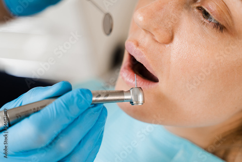 Dental drill close-up. Dentist drilling teeth of woman in dentistry clinic. Teeth treatment. Dental filling for girl patient.