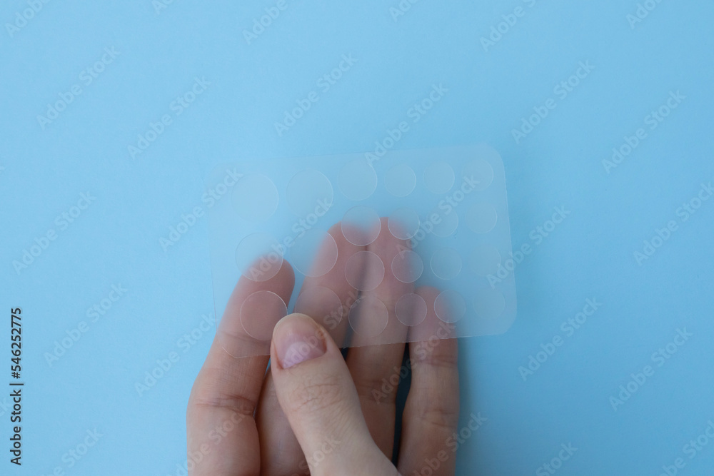 Sticker patches for acne and red spots on the skin in the hand of a ...