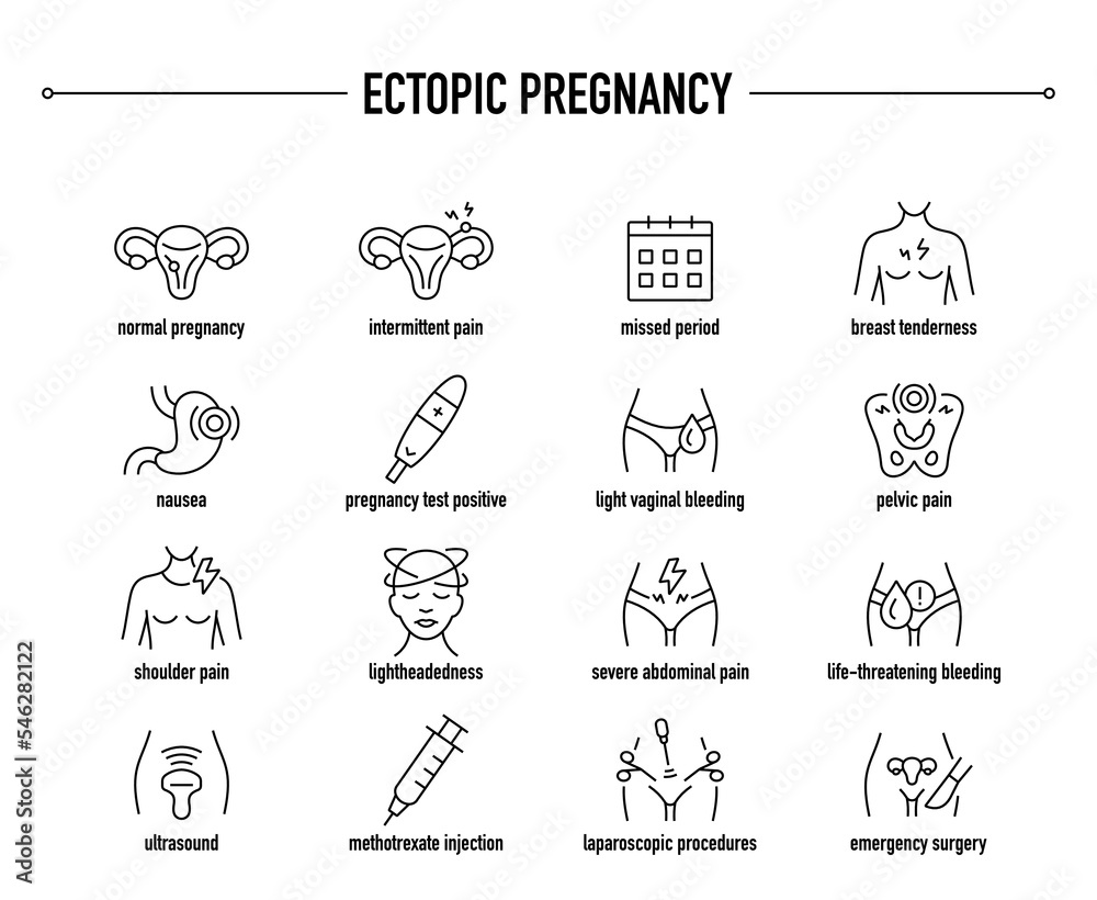 Ectopic Pregnancy symptoms, diagnostic and treatment vector icon set. Line editable medical icons. Ectopic Pregnancy symptoms, diagnostic and treatment vector icon set. Line editable medical icons.