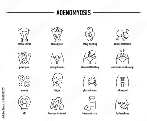 Adenomyosis symptoms, diagnostic and treatment vector icon set. Line editable medical icons.