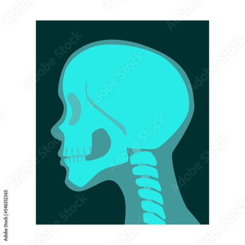 Ray of human skull side view vector illustration. Bones of skeleton, roentgen, radiography isolated on white background. Anatomy, medicine, health concept