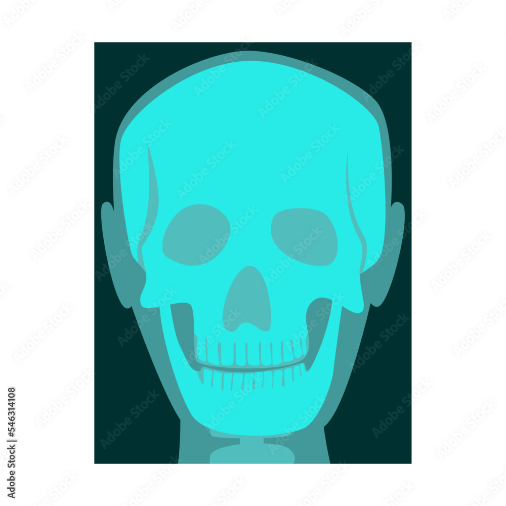 Ray of human scull vector illustration. Bones of skeleton, roentgen, radiography isolated on white background. Anatomy, medicine, health concept Ray of human scull vector illustration. Bones of skeleton, roentgen, radiography isolated on white background. Anatomy, medicine, health concept