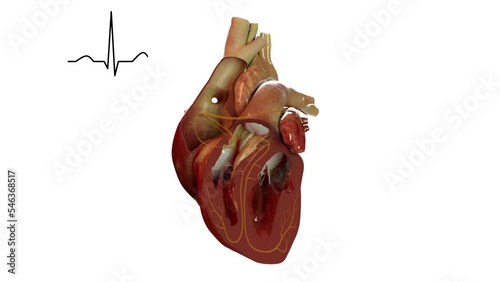 Human heart showing electrical activity in sync with and EGC (EKG)