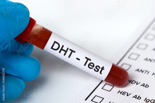 DHT test to look for abnormalities from blood photo