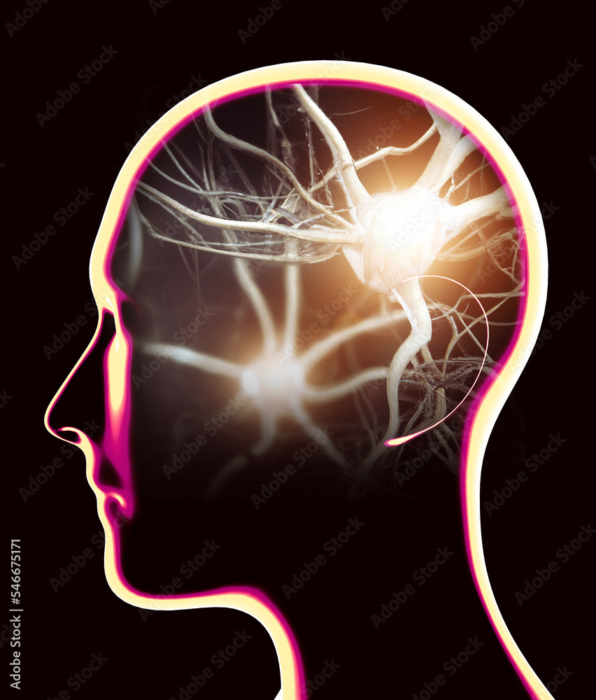 Section of a brain seen in profile, parts of the brain. Degenerative ...
